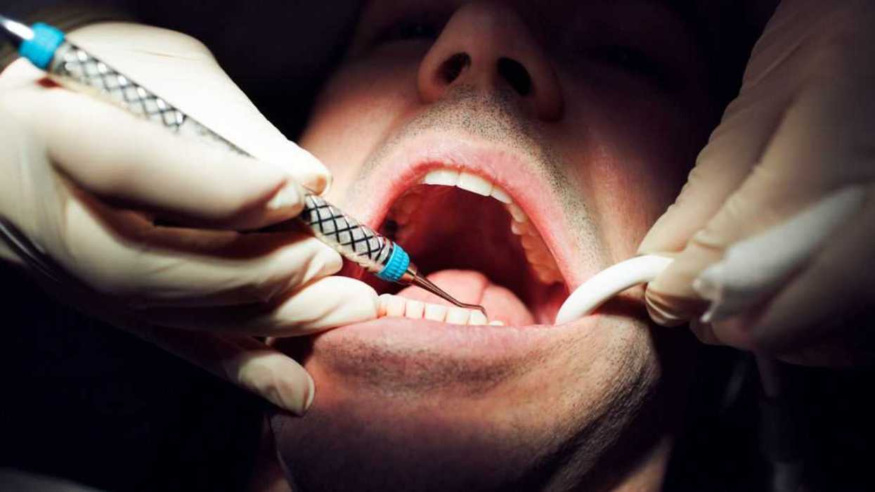A man has dental work done on his mouth