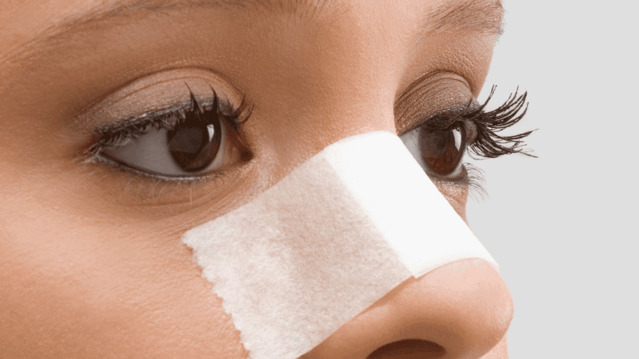 A woman with a bandage on her nose.