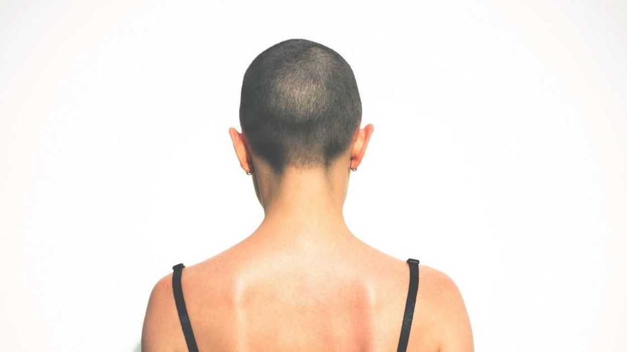 Teen Called Out For Shaving Her Head Two Weeks Before Sister's Wedding Following An Accident