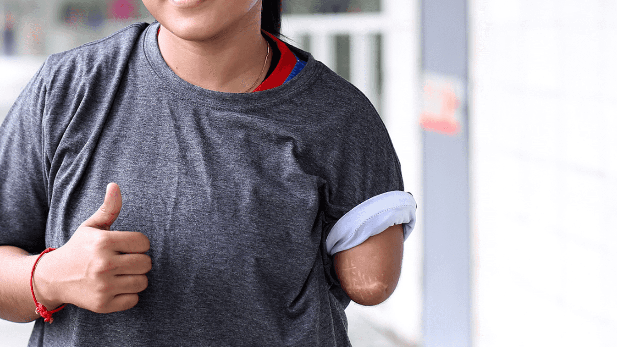 Pregnant Amputee Balks After Sister-In-Law Calls Her 'Lazy' For Buying Accessible Baby Equipment