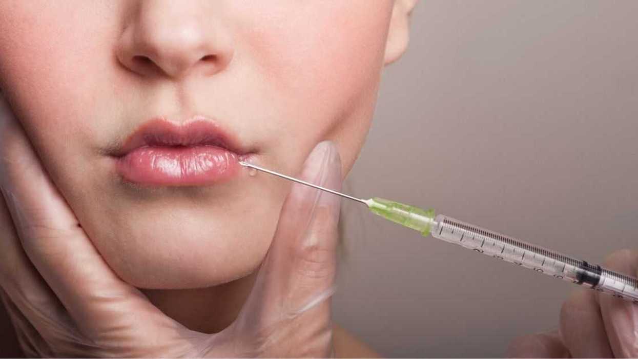 Woman Asks If She's Wrong For Calling Out Her Sister's Lip Injections In Front Of Strangers At A Bar