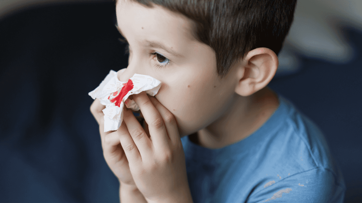 Boy with bloody nose