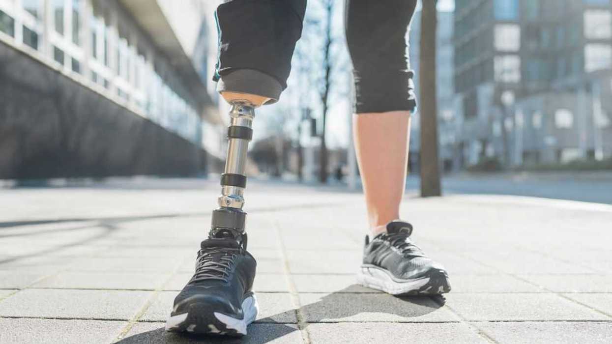Close-up of legs of sporty woman with leg prosthesis in the city.