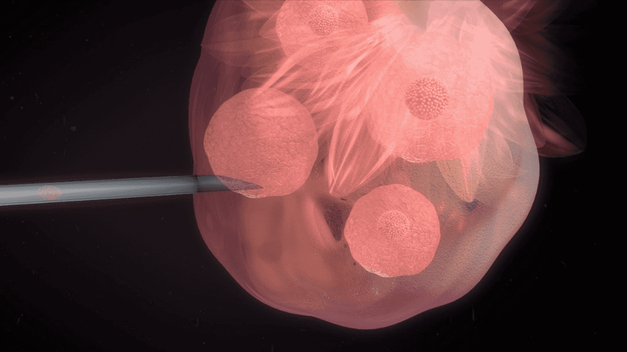 egg donation