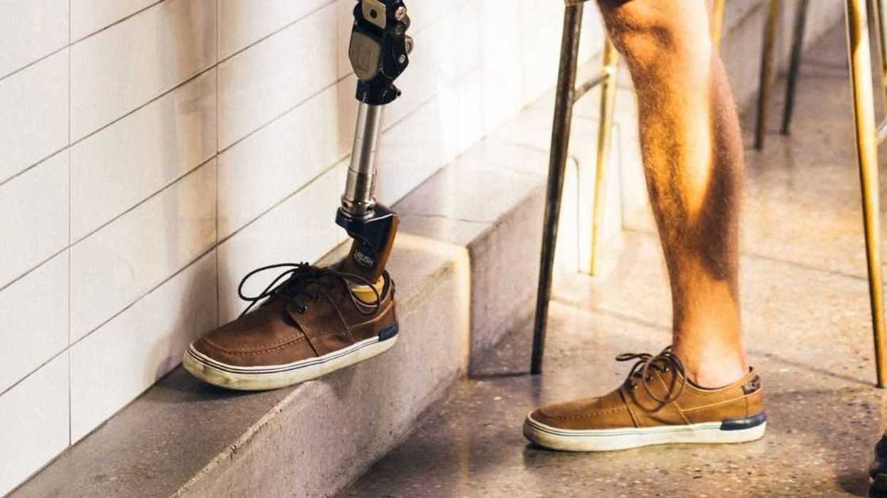 Guy Loses It After Random Dude At Party Takes His Prosthetic Leg And Refuses To Give It Back