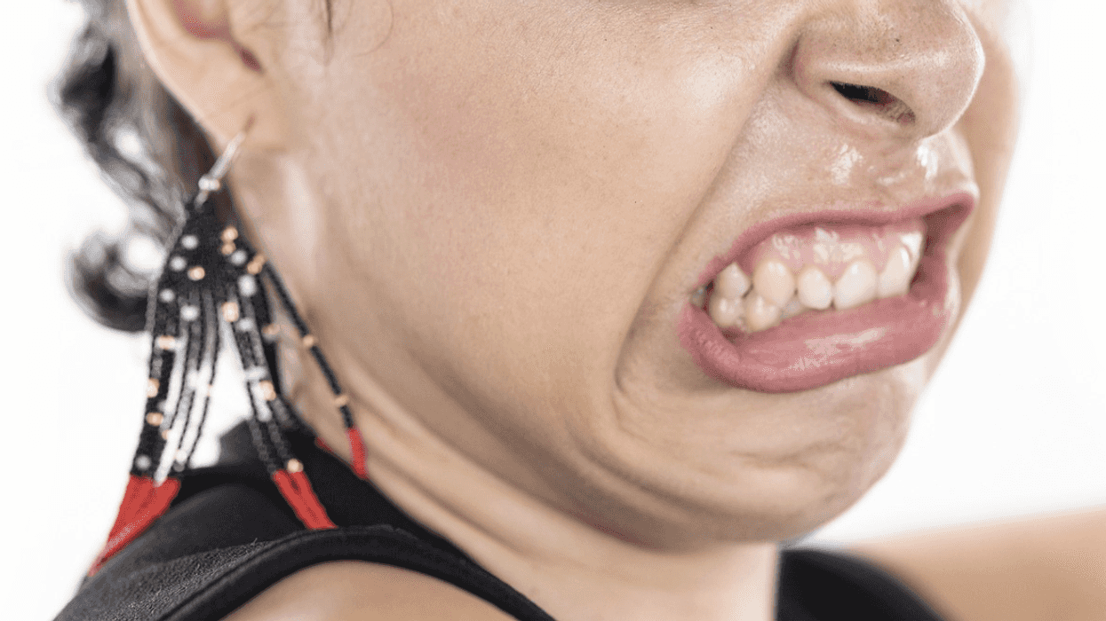 Home Cook Furious To Learn Mother-In-Law's Food 'Allergies' Are Actually Just Preferences