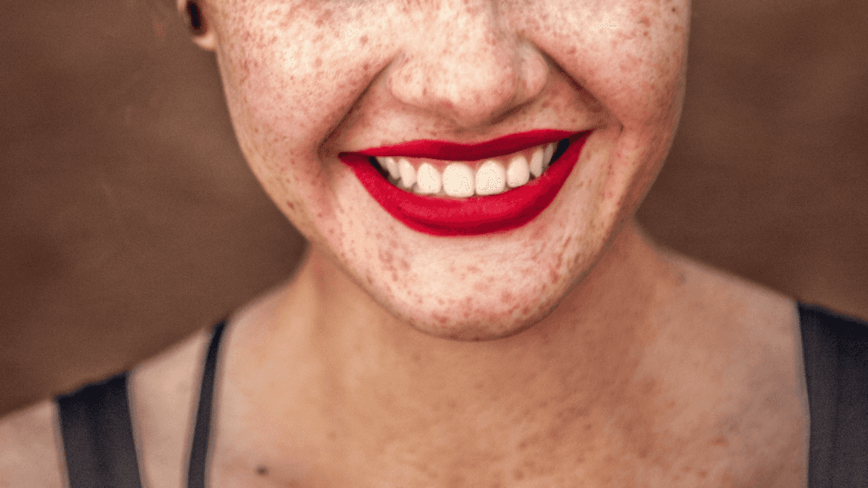 Guy Feels 'No Sympathy' For Sister Who Used To Bully Him After Her Beauty Treatment 'Gone Wrong'