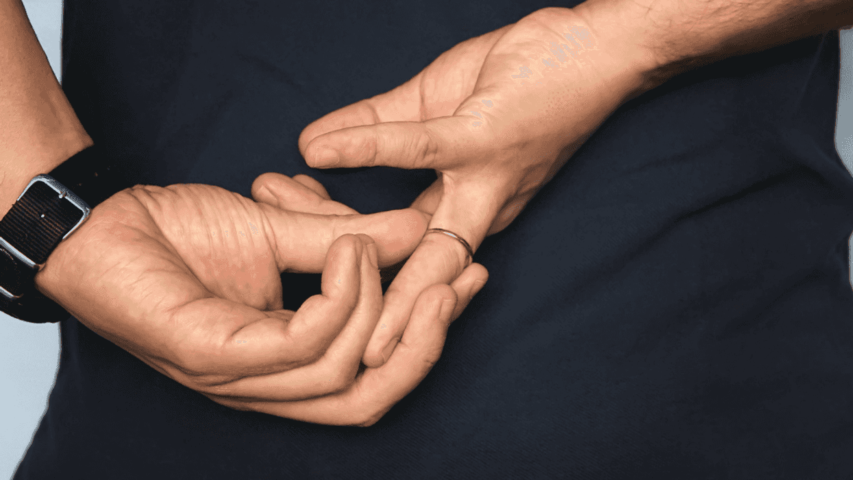 man removing wedding band