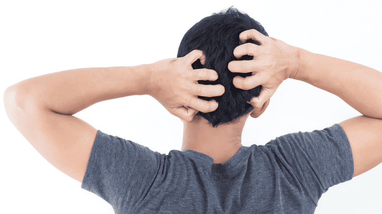 Man scratching his head because of lice