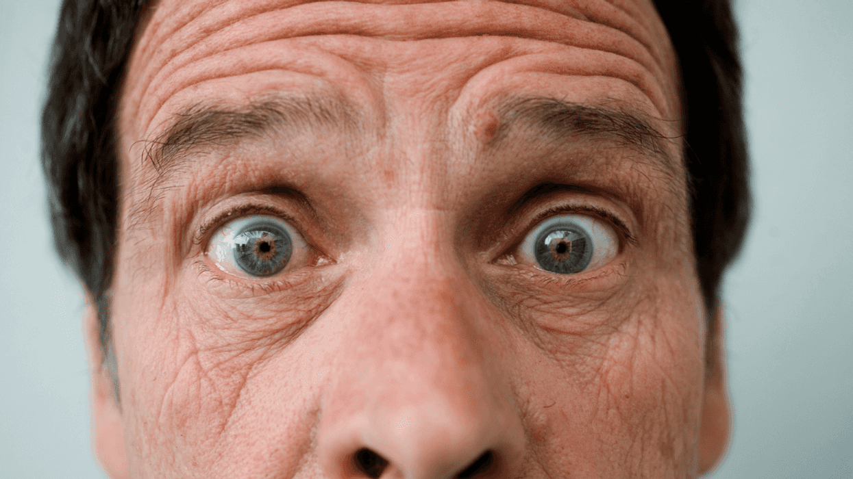 Man with eyes wide open looking directly into the camera.