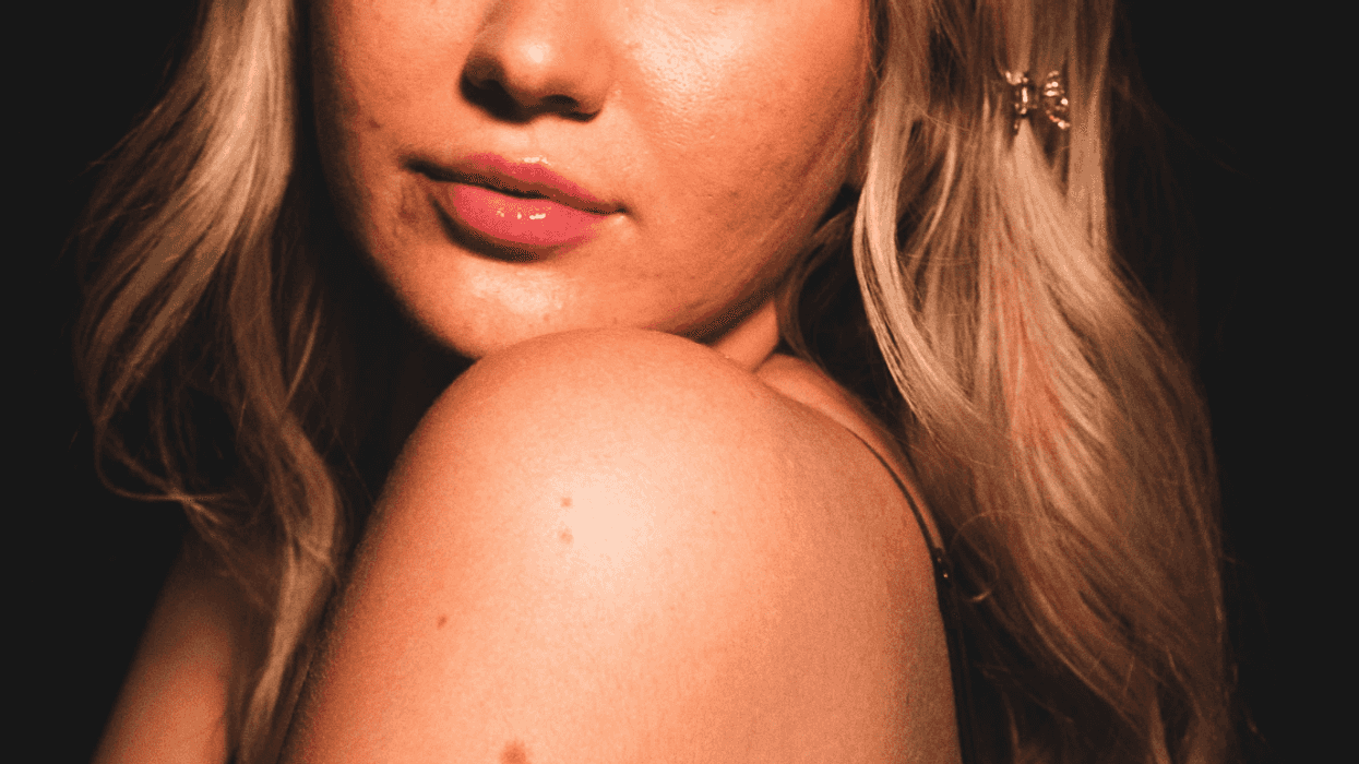 Dad Stunned After He's Berated For Making A 'Harmless Joke' About Teen Daughter's Acne