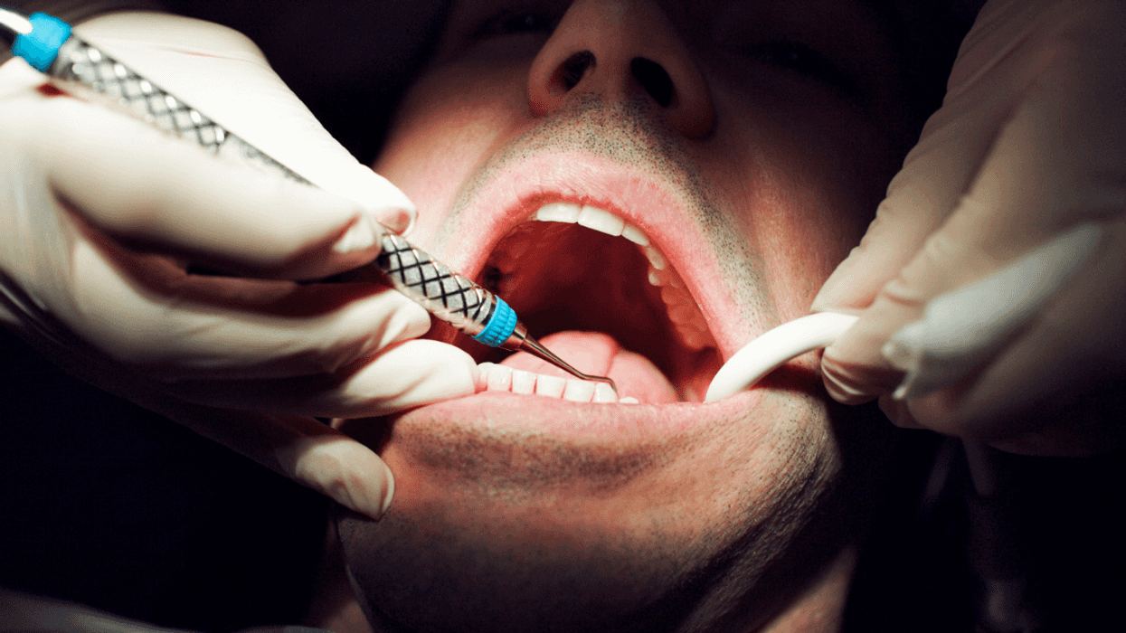 Guy Reports His Dentist For Saying He Has Teeth Like A 'Neanderthal' During Tooth-Pulling Appt.