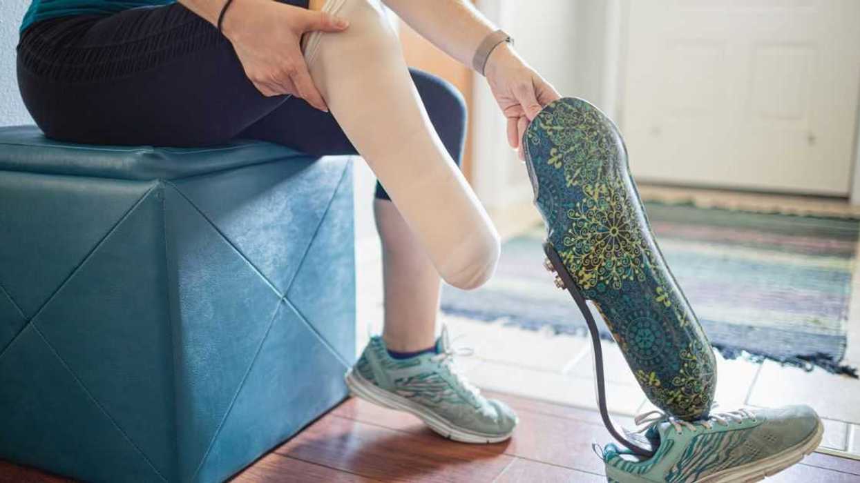 Woman Refuses To Take Off Her Prosthetic Leg Around Her Boyfriend