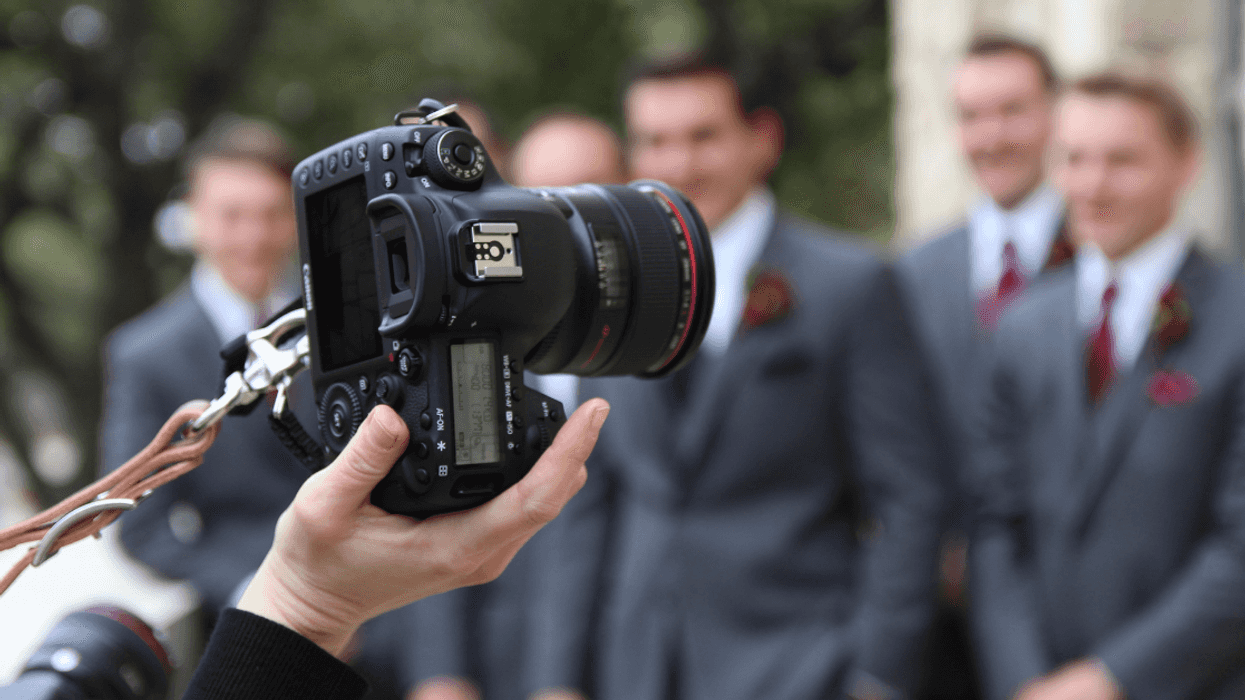 Woman Stunned After Fiancé Requests She Photoshop Her Facial Scar Out Of Their Wedding Photos
