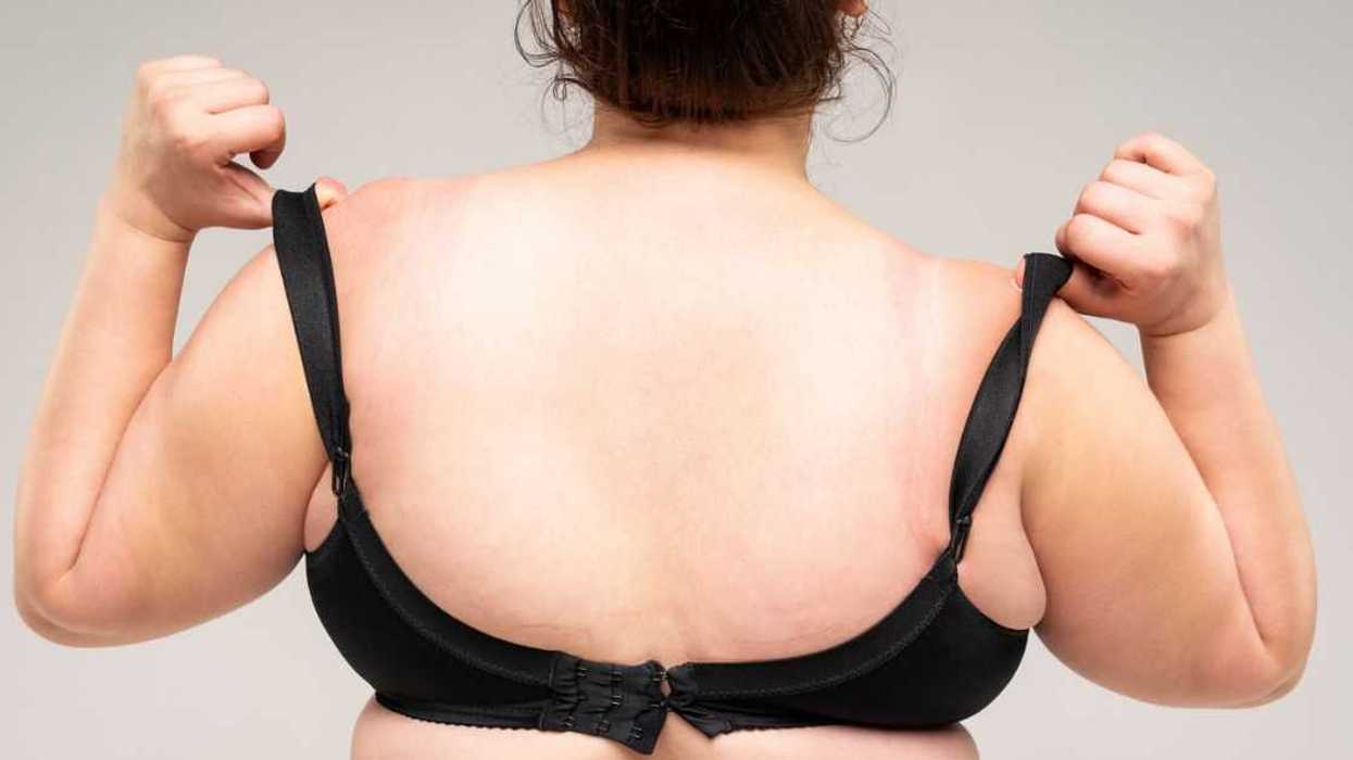 Overweight woman with fat back trying on a bra. She stands against a gray background.