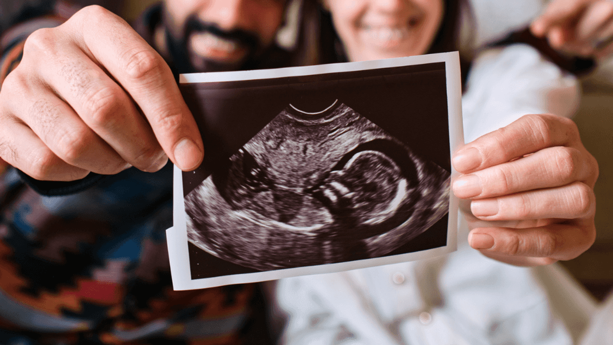 parents holding baby sonogram