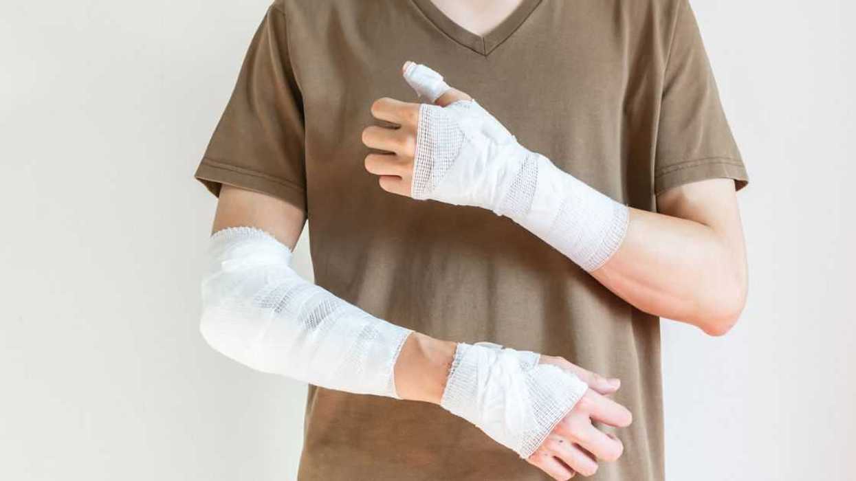 Person wearing two arm casts