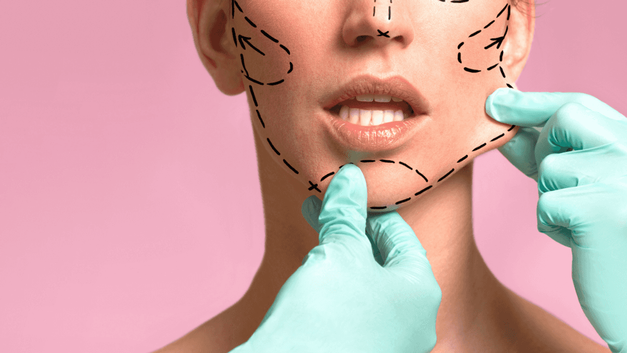 Redditor Called An 'A**hole' For Not Telling Their Date They'd Previously Had Plastic Surgery