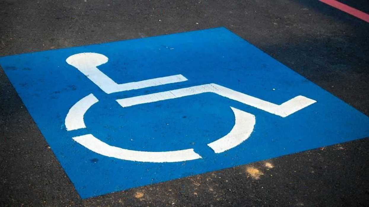 Woman Takes Off Prosthetic Leg To Prove Point After Altercation Over Handicapped Parking Space