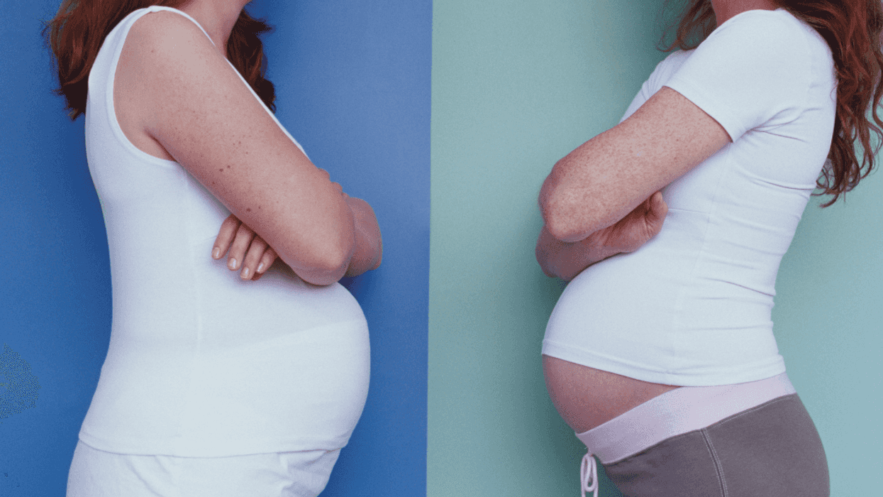 pregnant women facing each other