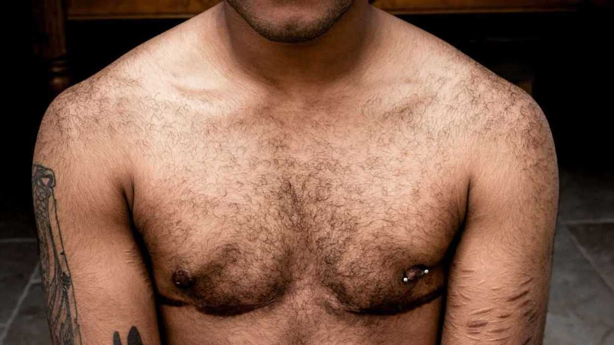 Woman Livid When Trans Brother Leaves Pool Party Early After She Demands He Leave His Shirt On