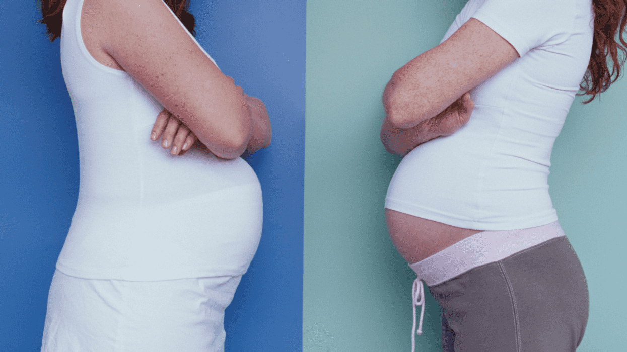 Two pregnant women facing each other