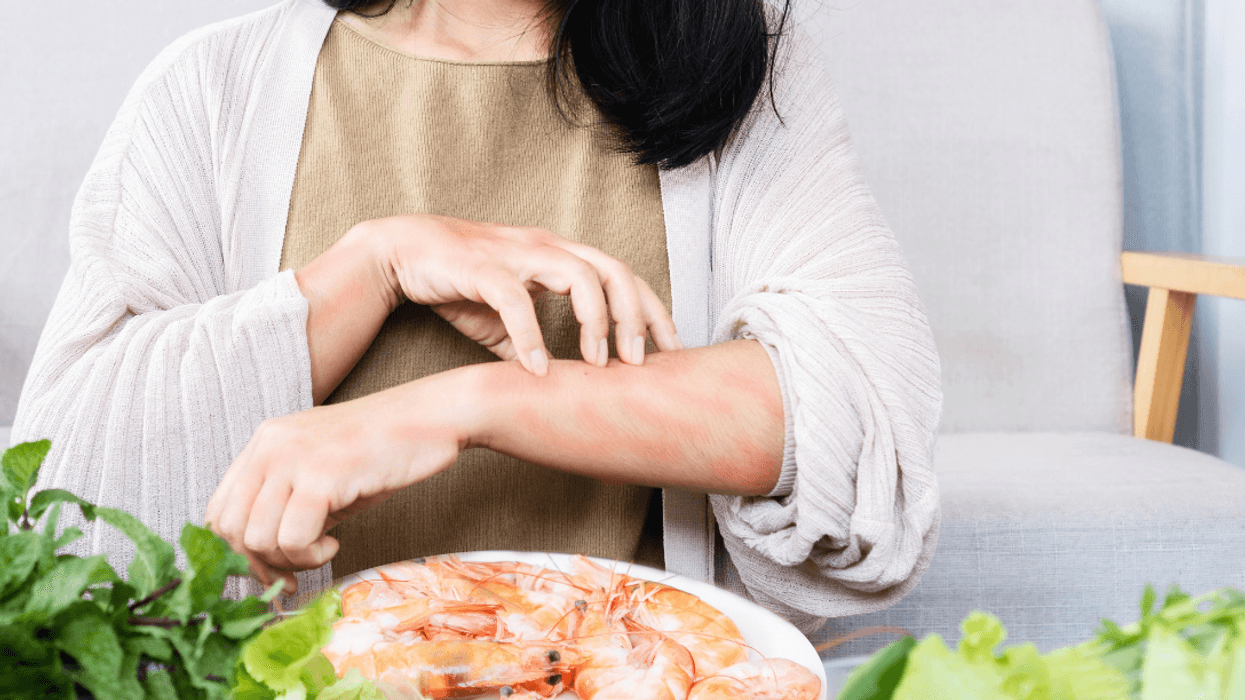 woman having allergic reaction to shellfish