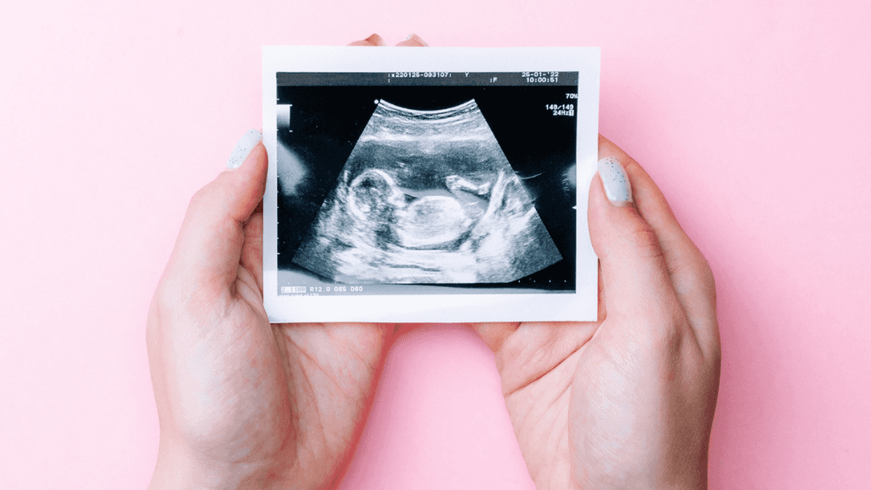 Woman holding an ultrasound picture