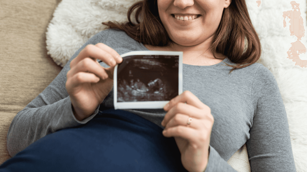 Woman holding ultrasound photo