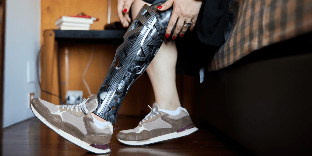 Woman With Prosthetic Leg Slams Friend's Rude Girlfriend For Assuming She Has Eating Disorder | Percolately