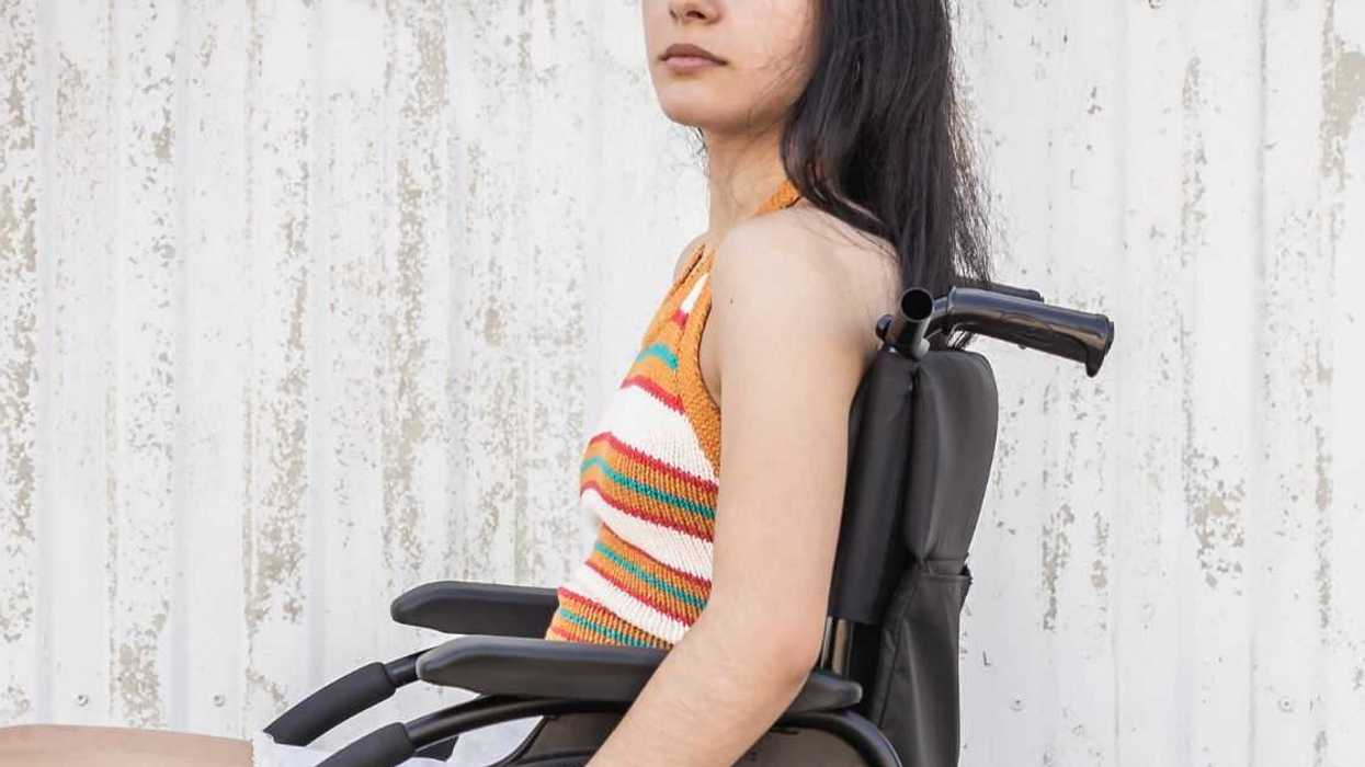 Young handicapped girl with depressed expression looks directly into the camera.