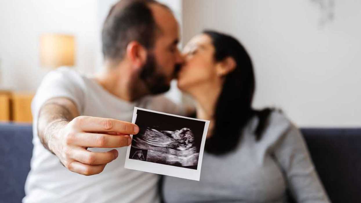 Young, happy couple sharing a loving kiss on the sofa, proudly holding and displaying their ultrasound scan of a baby on the way.