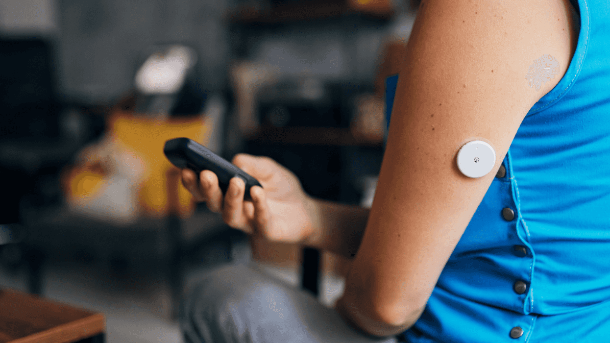 Young woman with insulin pump.