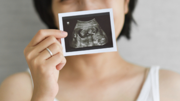 Excited woman holding ultrasound picture