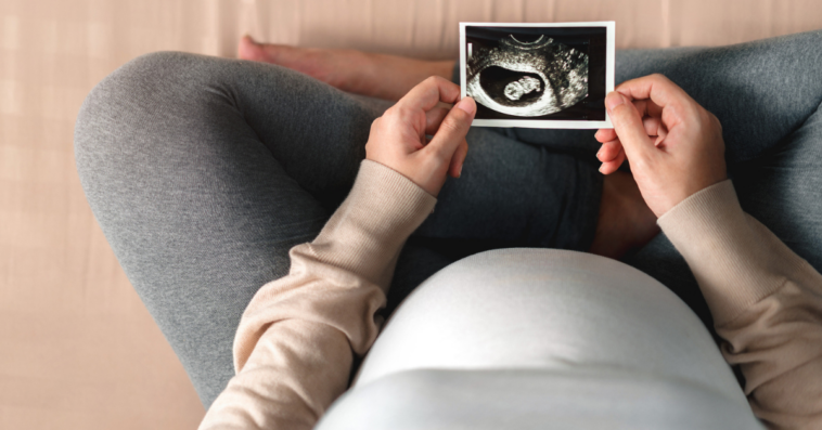Pregnant woman looking at picture of ultrasound