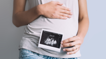 Woman holding an ultrasound photo