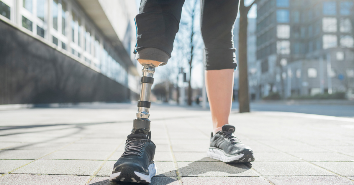 Teen With Prosthetic Leg Scolded By Elderly Lady On Train