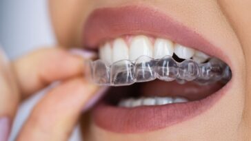 A women puts on a Clear Aligner Dental Night Guard For Teeth