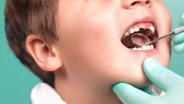 A smiling boy being examined at the dentist