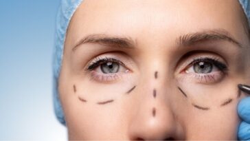 Surgeon marking woman's face for cosmetic plastic surgery. Facelift procedure.