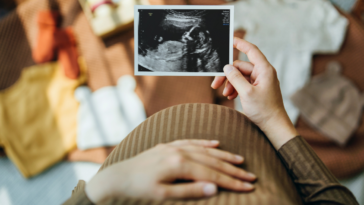 pregnant person looking at ultrasound