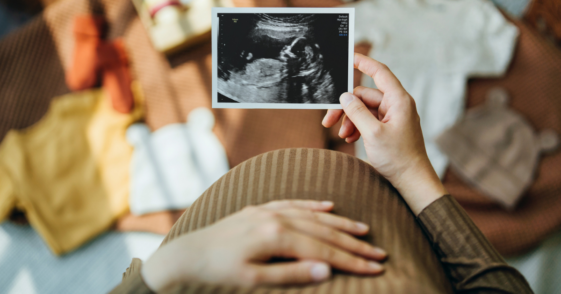 pregnant person looking at ultrasound