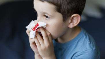 Boy with bloody nose