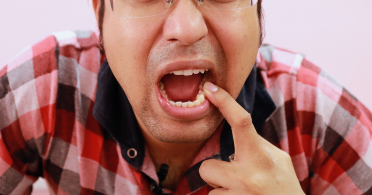 man poking at teeth after meal