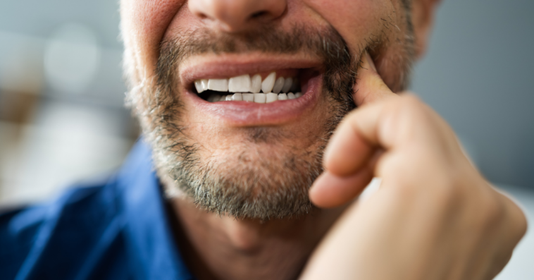 A man showing his teeth and massaging his jaw.