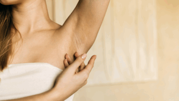 A woman lifting up her arm and revealing her armpit.