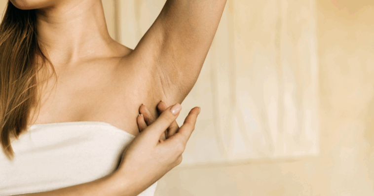 A woman lifting up her arm and revealing her armpit.