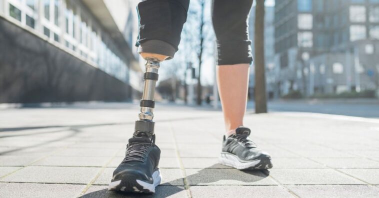 Close-up of legs of sporty woman with leg prosthesis in the city.