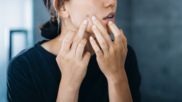Woman examining a pimple