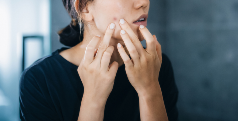 Woman examining a pimple